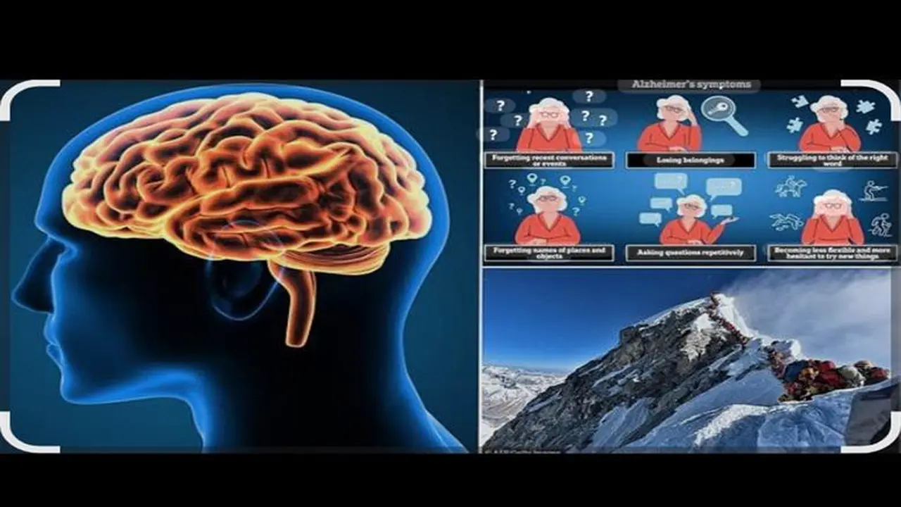 تنشيط العقل بالذّاكِرة: 10 ألغاز مع حلول تعزز سرعة الاستجابة الذهنية
